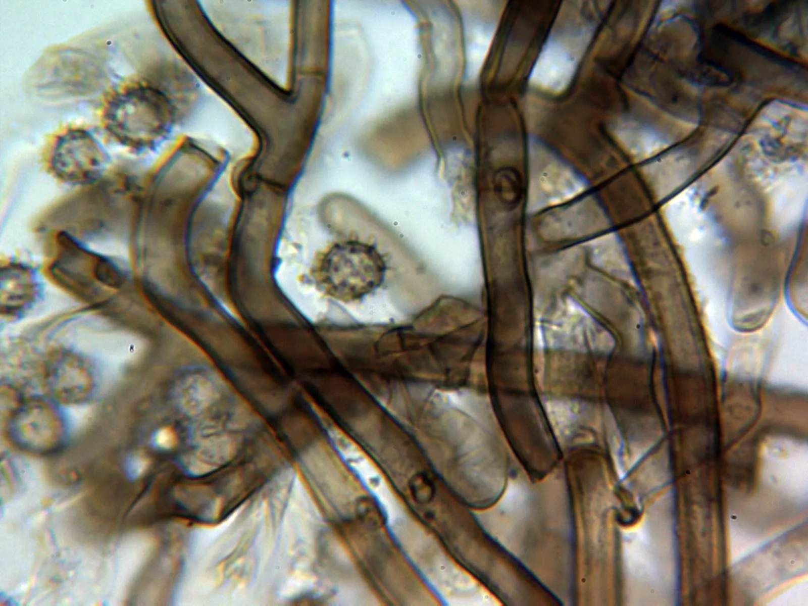 Microscopía de Tomentella cinerascens - 10 - Hifas subiculares KOH